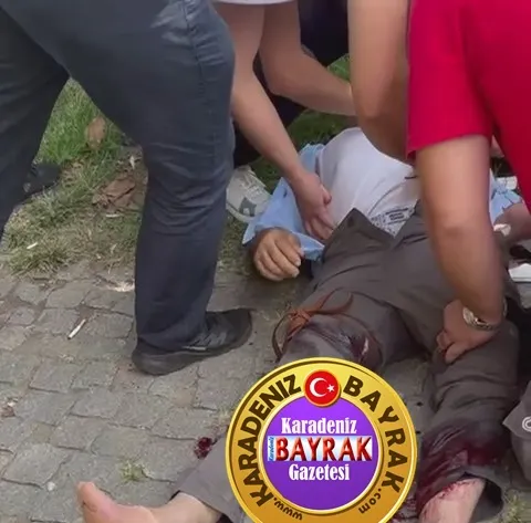 Ordu’da bir kişi silahla bacaklarından vuruldu 